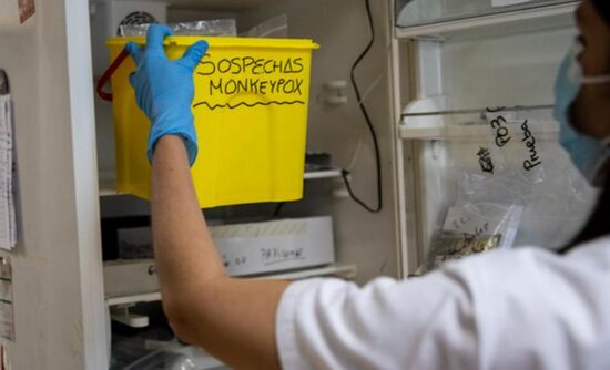 Una técnica de laboratorio recoge un cubo con muestras sospechosas de viruela del mono para analizarlas en Madrid. Foto: Pablo Blazquez /Getty Images.